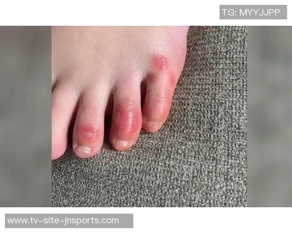 恩昆库脚趾疼痛基本消失或将入选对比萨比赛名单